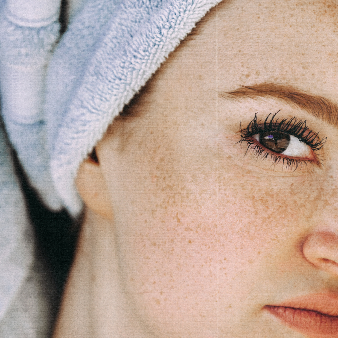 3 Products that Work Well for Reducing Hyperpigmentation by Katie Pierce