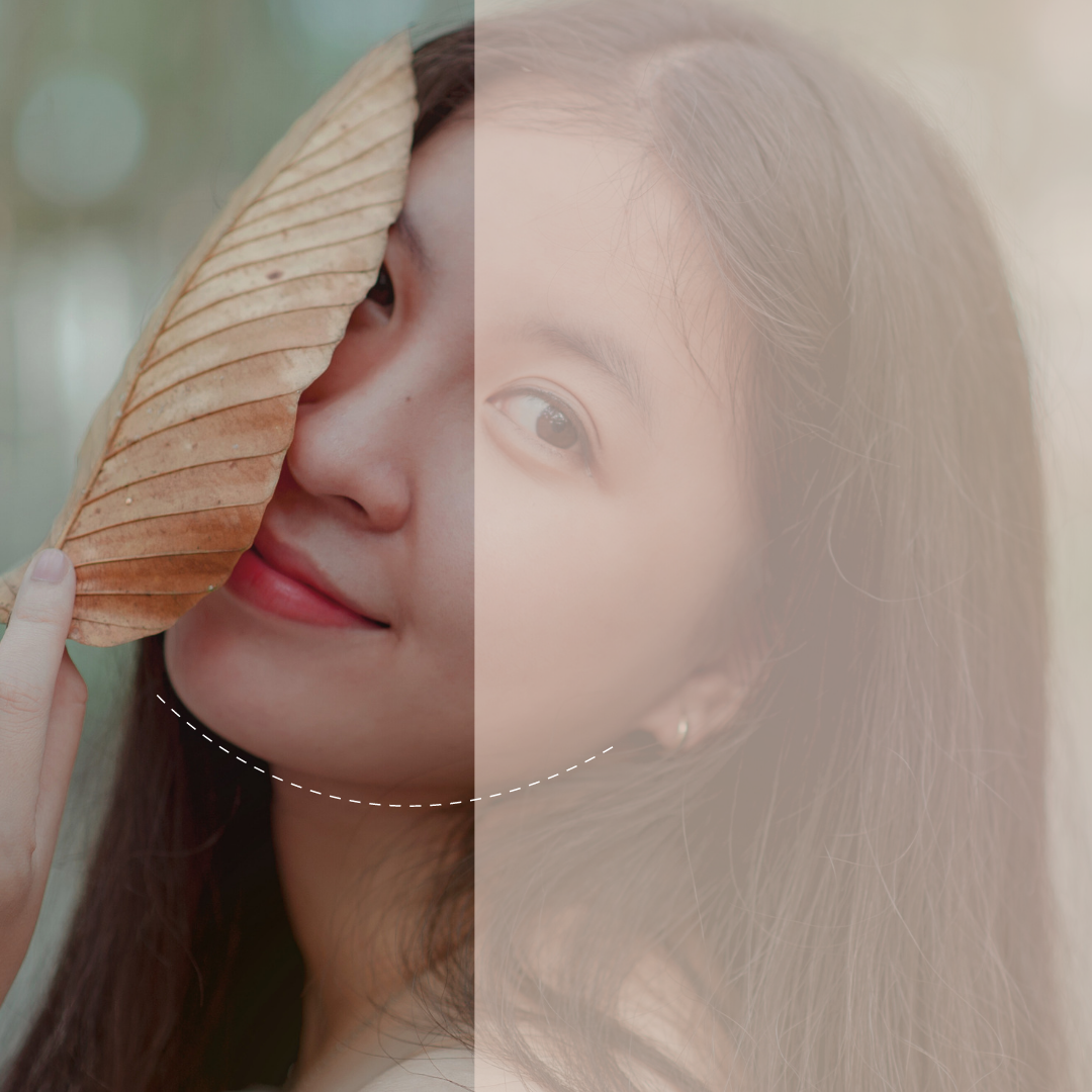 Managing your Skin During this Winter Season